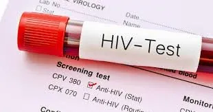 Gezondheidsinstanties willen hiv-besmettingen afremmen en meer mensen op behandeling